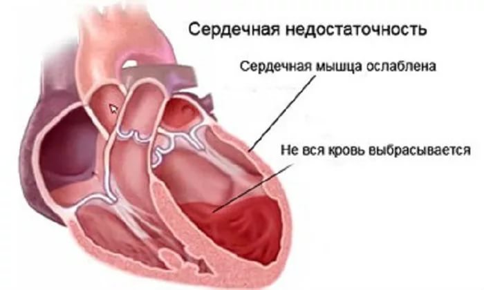 Углеводы и здоровое сердце